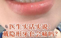 隐形矫正牙齿好吗