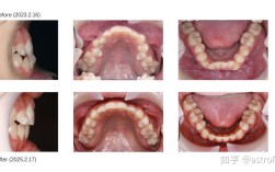 北大口腔医院正畸科刘