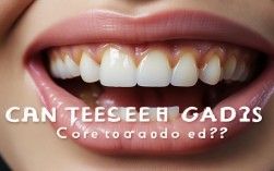 2025年牙齿有缝隙还能矫正吗?现在来得及!