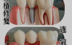 镶牙和植牙美冠塔专业