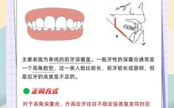 磨牙深覆盖正畸方法有哪些？不同矫正方式效果差异多大？