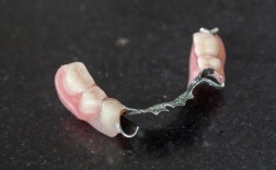 镶活动牙的方法是什么？有哪些操作步骤？