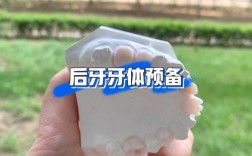 后牙牙体制备常用方法及其操作要点是什么？