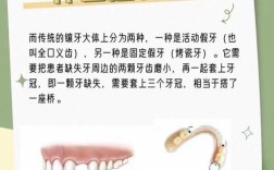 种牙的长处究竟有哪些？这些优势如何帮助患者？