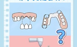 该选正畸还是种植
