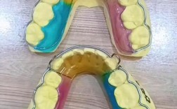 正畸环绕时保持器