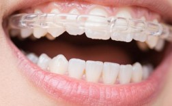 正畸后牙齿终生戴保持器，真的需要戴一辈子吗？