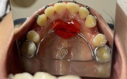 成都华美牙科牙齿正畸效果好不好？体验如何？