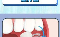 活动义齿设计方法的关键步骤与原则有哪些？