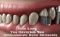 矫正骨钉要戴多久？2025最新周期解答