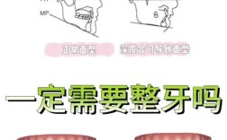 牙齿深覆盖怎么矫正