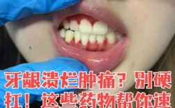 种牙麻药过后疼不疼