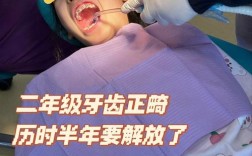 儿童牙齿矫正，几岁开始最合适？如何选方法？