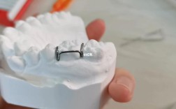 正畸箭头卡环弯制视频是否详细演示了托槽定位与角度控制？弯制过程中需注意哪些关键细节才能确保固位稳定？