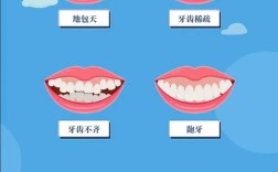mbt直丝弓正畸费用