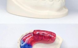 正畸导板图片能看出牙齿矫正的关键效果吗？