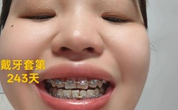 40岁矫正牙齿还来得及吗？效果会受年龄影响吗？