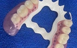 种牙前为何要戴义牙？作用与必要性是什么？