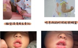 小孩反颌有哪些常用治疗方法？