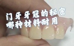 全瓷牙修复中如何正确密封？关键步骤方法与注意事项详解