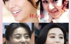 明星们正畸拔牙了吗