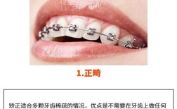 牙齿有缝隙用什么方法