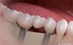 江西拜博口腔牙齿矫正效果与价格怎么样？