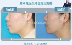 矫正牙齿保守治疗适用哪些情况？效果如何？