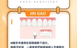 掉牙后多久种牙