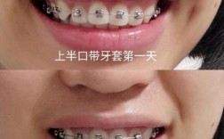 沈阳矫正牙齿好的地方