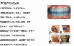 牙齿矫正器构造