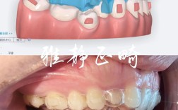 隐形矫正牙齿推荐，怎么选品牌才靠谱？