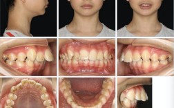 国际著名正畸杂志聚焦哪些正畸前沿研究方向？