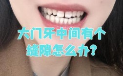 正畸中门牙有缝隙是什么原因导致的？