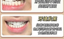哪种美白牙齿的方法好