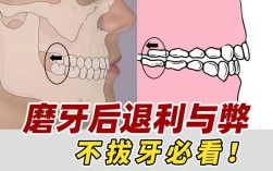 不拔牙矫正牙齿有哪些可行方法？效果如何？