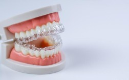 正畸拉簧一下拉5颗牙齿，效果真的安全又高效吗？