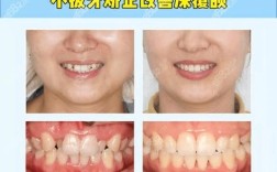 北京牙齿矫正哪家好？求推荐靠谱机构，想看真实案例反馈！