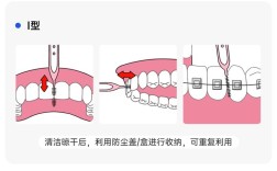 前牙牙间刷使用方法
