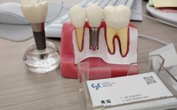 种牙材料用纤维有何新优势？