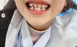 矫正一半出国，后续治疗如何继续进行？