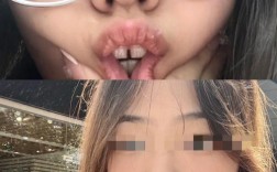 矫正后牙缝很大，是什么原因？该怎么解决？