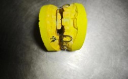 正畸大牙上的颊管是什么？正畸中为何重要？