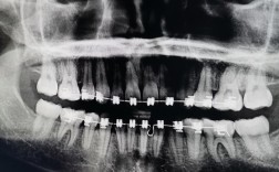深圳美奥口腔正畸
