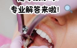 牙齿矫正不需要拔牙