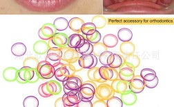 正畸链状橡皮圈图片