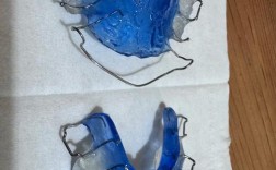 牙齿反颌矫正器图片能看清哪些细节？