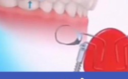 正畸磨牙后推是什么？有何作用与原理？