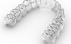 无托槽隐形牙齿矫正术