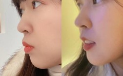 长沙牙齿矫正哪里好？专业医院/诊所怎么挑？效果价格都靠谱吗？